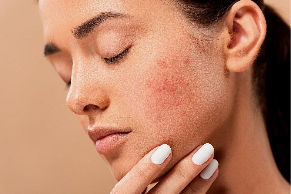 Saiba o que pode causar problemas em sua pele